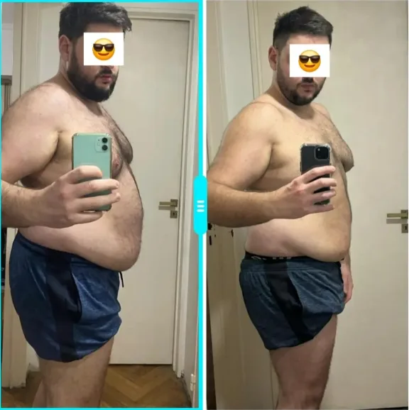Transformación 1